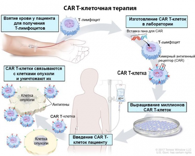 Схема CAR T-клеточной терапии Схема CAR T-клеточной терапии