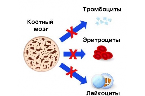 При апластической анемии нарушается выработка всех клеток крови При апластической анемии нарушается выработка всех клеток крови